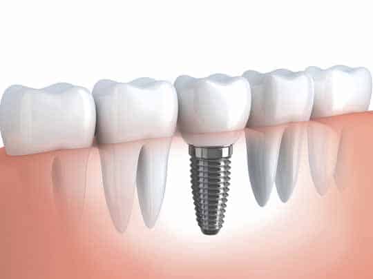 Optima Dental Surgery Center