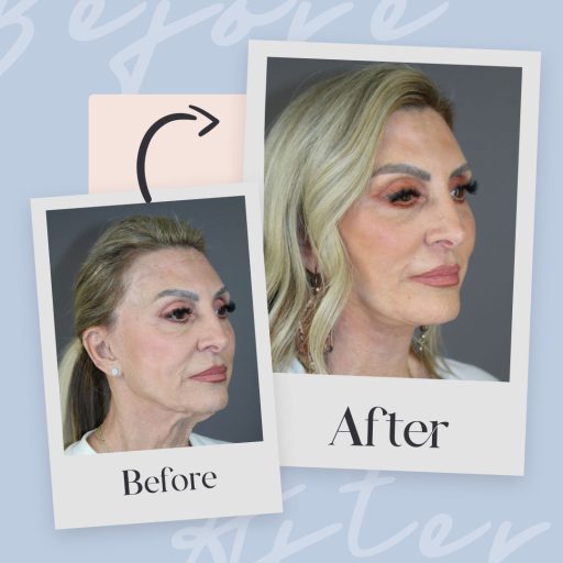 Leo Lapuerta, MD Plastic Surgery