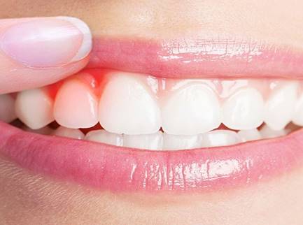 Azle Smile